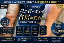 トータルクリア(TOTAL CLEAR)