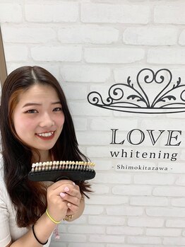ラブホワイトニング 下北沢店(LOVEホワイトニング)/たった4カ月でこの白さ!