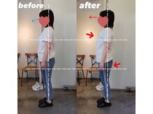 ピエール ナリタイラボ 薬院店(Piel NARITAI LABO)/視線もバストもUP♪