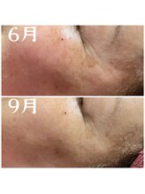 リンク(LiNK)/☆50代でも遅くない☆