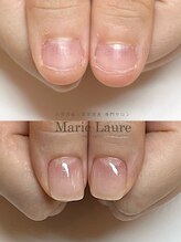 マリーロール 淀屋橋本店(Marie Laure)/自爪育成/深爪矯正/ネイルケア