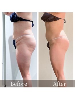 インフィニーズ(INFINEEZ)/カスタマイズ120分痩身60代