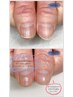 HAND◇深爪を縦長なお爪に導きます！《自爪育成》