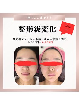 サロン叶(kanau)/人気No.1。頭から小顔に