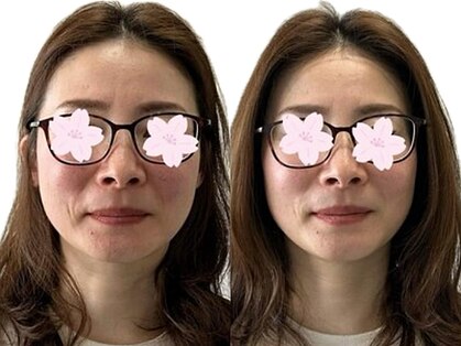 はりきゅっとの写真