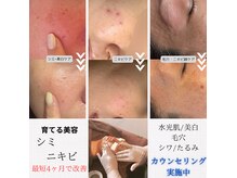 ネイルアンドビューティー モアリボン(Nail&Beauty More Libbon)