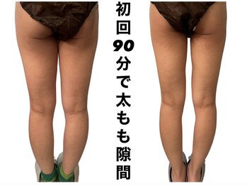 ジール(ZEAL)/痩身/ダイエット　初回のお客様