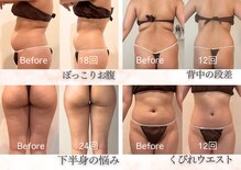 ハナ チュチュ(Hana chuchu)