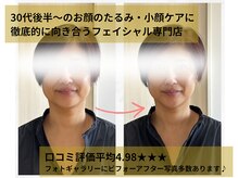 シュシュ(Chouchou)