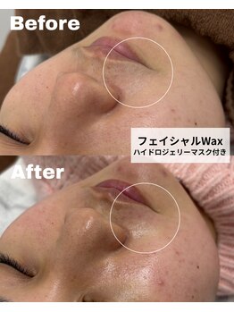 ナインオブカップス(9 of cups)/艶肌フェイシャルWax/Wax脱毛
