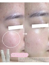 ラボーテエサンテ バイ ティアラ(la beaute et sante by Tiara)/TIPパレットピールでなめらか肌