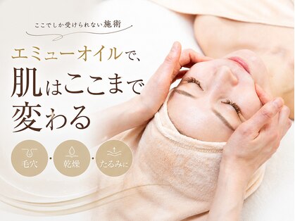 エミ(emi)の写真