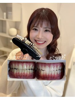 エランホワイトニング 一社店の写真/結婚式やイベントに向けて来店されるお客様大変多いです☆【ブライダルクーポン有】