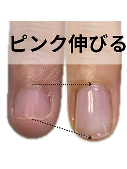 リフレシア(Rifrecia)/信じて通ってくださった結果