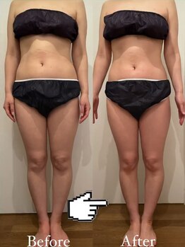 シェリスパ(Cheri Spa)/お腹周りもすぐスッキリ♪