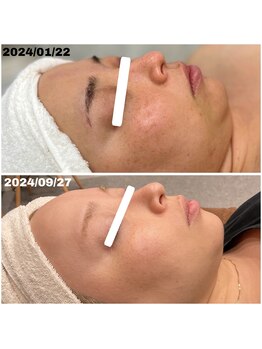 ココ(Coco)/8か月後の変化