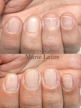 マリーロール 梅田店(Marie Laure)/深爪矯正/自爪育成/ネイルケア