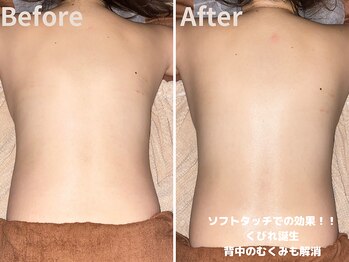 グレース 吉祥寺(grace)/ソフトタッチで流れる背中の細胞