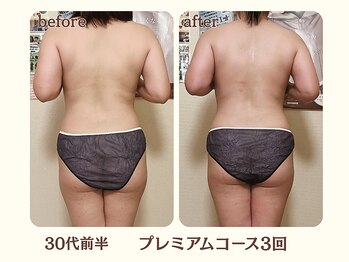 ヨサパーク ハーブ イムア(YOSA PARK imua)/◎お客様の変化