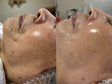 フェリス(FELIZ)/歳を重ねて出来たシワにはコレ！