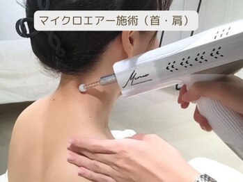 リジェネラティブセル メディカルサロン(Regenerative Cell Medical Salon)/首、肩こりのケアに