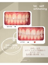 スリール(sourire)/