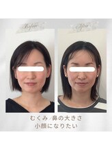 りもあず(ReMore-S)/顔が疲れて見える/鼻の大きさ