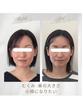 りもあず(ReMore-S)/顔が疲れて見える/鼻の大きさ