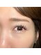 アンジーネイルアイラッシュ(Angie Nail Eyelash)の写真/二重瞼、一重瞼のどんなお悩みも解決します！スピーディーな高技術を体験下さい！