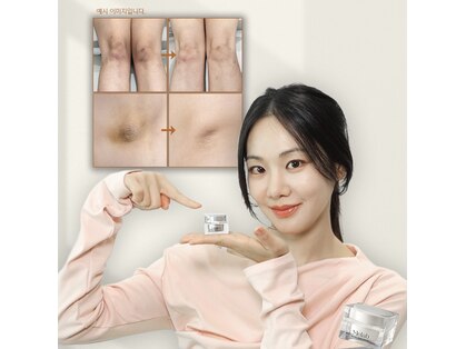チョアビューティー(choa beauty)の写真