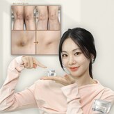 チョアビューティー(choa beauty)
