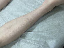 ナノハナ/鹿沼市全身脱毛美容室ナノハナ