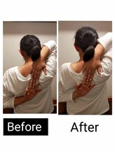 アース エンジェル整体院/ビフォアフ　肩甲骨はがし