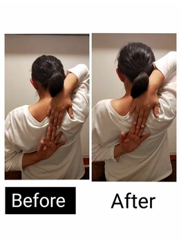 アース エンジェル整体院/ビフォアフ 肩甲骨はがし