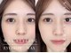 アンドアルファ 浜松(&α)の写真/自然な眉毛を目指す方ナチュラル感のある顔を目指す方◎理想の眉毛が綺麗にキマる♪眉毛/美眉/アイブロウ