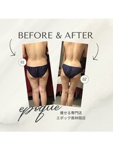 エステティックサロン エポック(epoque)/ＴMキューブ★スリムボディへ