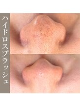 シアー(SHEER)/■ハイドロスプラッシュ