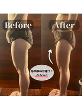 サロンドゥードゥー(SALON DOUDOU)/下半身集中(-3ｃｍ！)