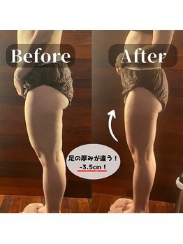 サロンドゥードゥー(SALON DOUDOU)/下半身集中(-3cm!)