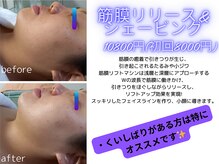アリ(ARI)の雰囲気（マシンでコリをほぐし筋肉運動で引き締め本来のフェイスラインへ）
