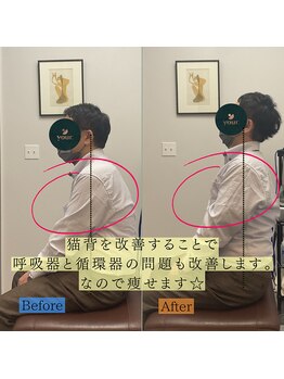 ユア(your.)/1度の猫背矯正