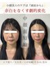 【No. 1究極小顔メソッド】頭蓋骨小顔矯正★美人の条件全制覇！脂肪0美容液付