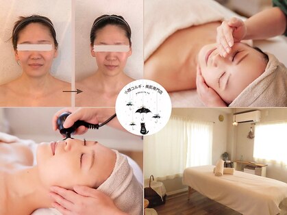 アメアラレ(amearare)の写真