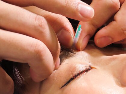 サンテ鍼灸院 整骨院の写真