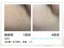 リル(Rire)/Before→After