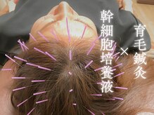 リアン(Re-Ane)