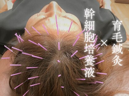 リアン(Re-Ane)の写真