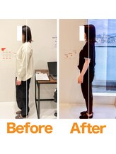 整体院ひなた 宮崎院/姿勢が変わり自信が持てました!!