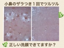 エクラの雰囲気（ハイドロフェイシャルで毛穴洗浄＆老化角質除去ニキビケアにも◎）