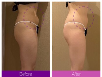 クレヴィア バイ サイバーエステ(CREBIA)/【ボディ90分回数券】10回